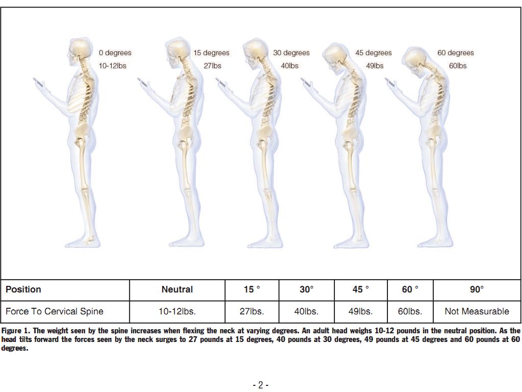 Cervical stress from smartphone abuse - ComputArte